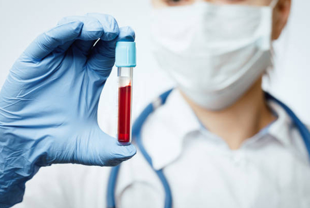 Blood Test Checkup in Naigaon