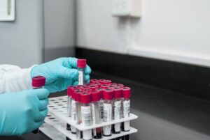 Read more about the article Best Stool Testing Labs in Naigaon