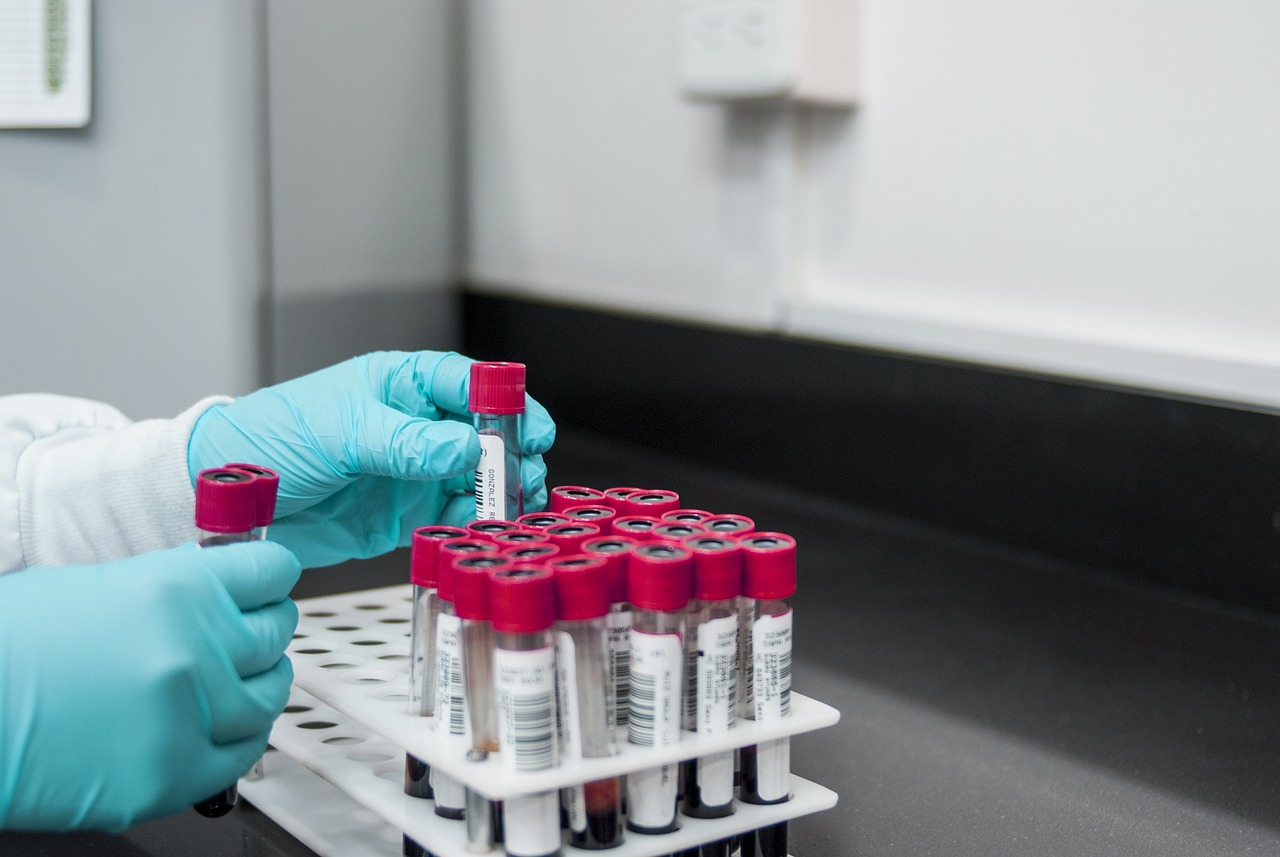 Read more about the article Best Stool Testing Labs in Naigaon