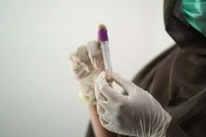 Read more about the article HCV Antibody Test Center in Naigaon