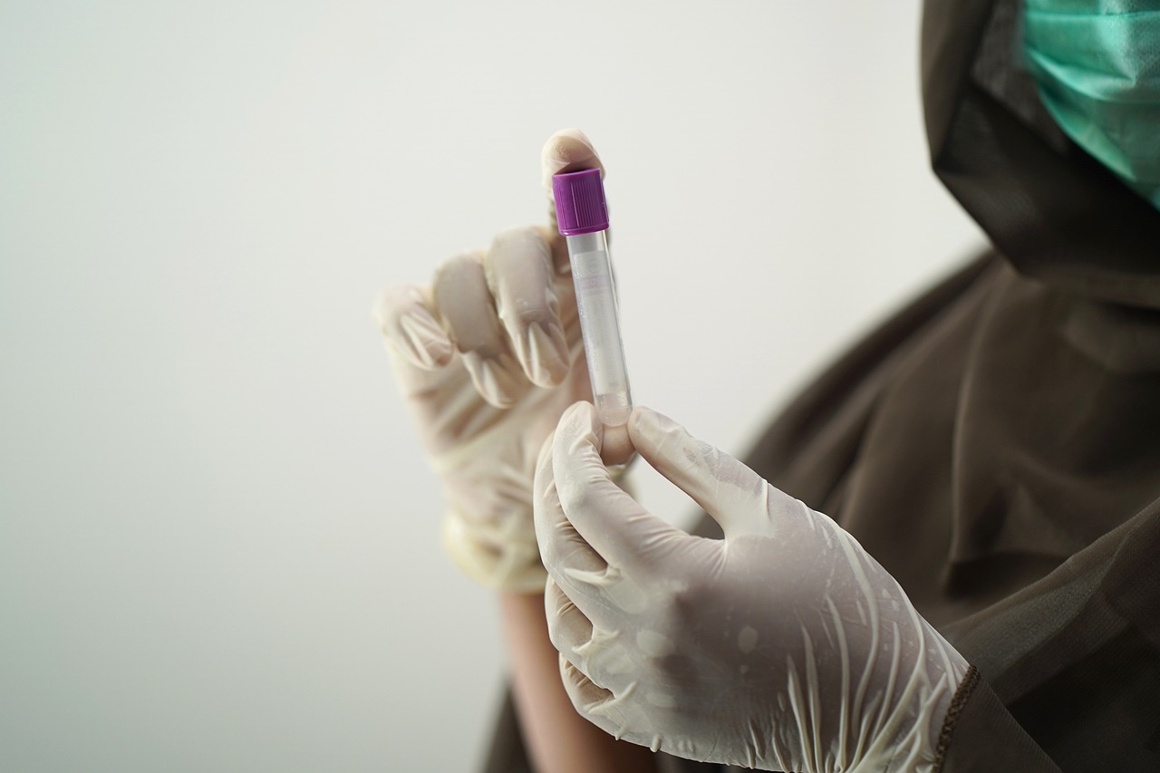 Read more about the article HCV Antibody Test Center in Naigaon